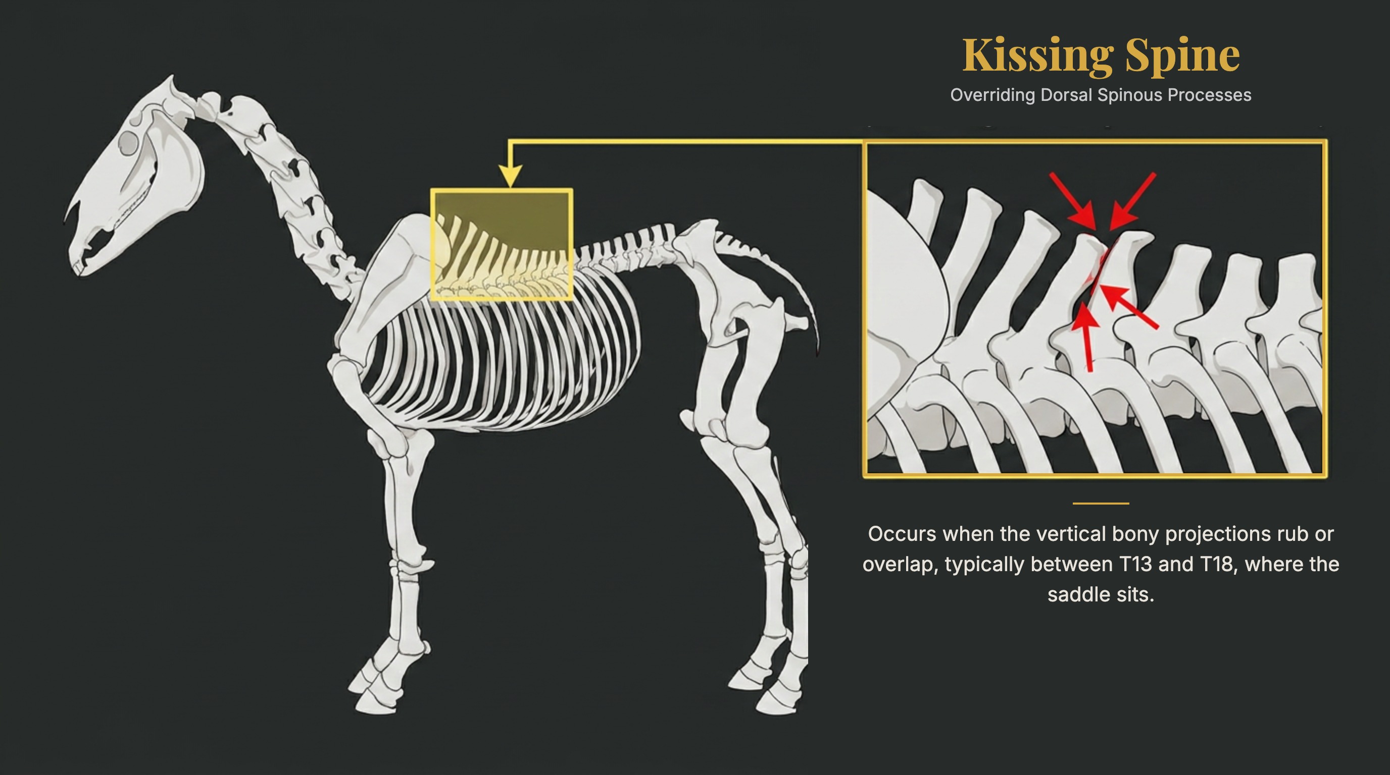 Kissing spine diagram showing overriding dorsal spinous processes in a horse skeleton between T13 and T18